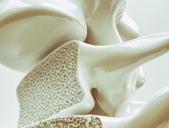 24 czerwca 2025 r. - Ważny dzień w kalendarzu. Światowy Dzień Chorych na Osteoporozę