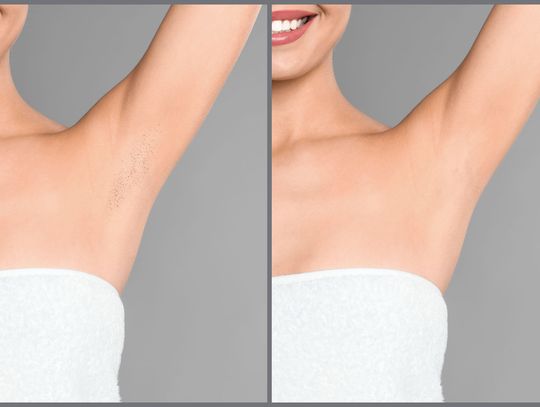 Depilacja laserowa a tradycyjne metody golenia – co wybrać?