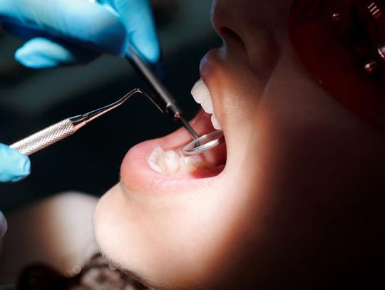 Kurs dla higienistek stomatologicznych i praca z dziećmi