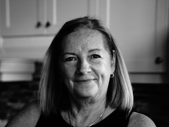 Wypełniacze fałdów nosowo-wargowych: wszystko, co musisz wiedzieć przed zabiegiem